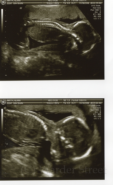 3rd Ultrasound 04.jpg